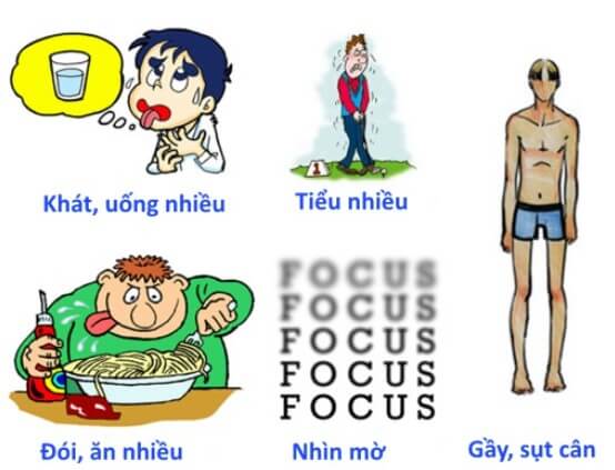 Triệu chứng bệnh tiểu đường tuýp 1