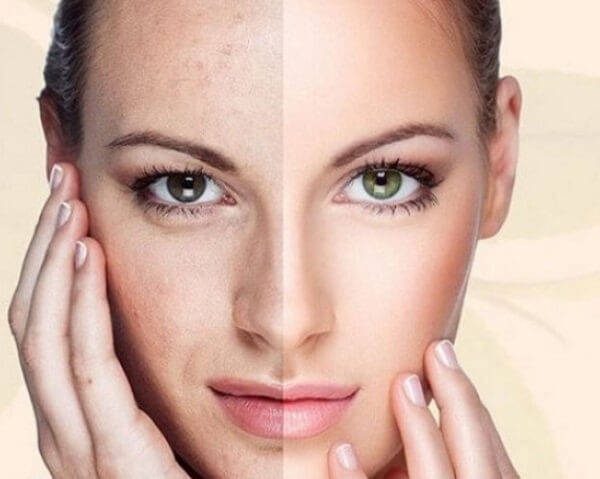 Ăn dưa lưới giúp bổ sung nhiều dưỡng chất cho da