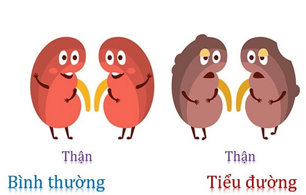 Biến chứng thận do bệnh tiểu đường