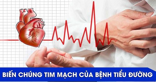 Biến chứng tim mạch của bệnh tiểu đường