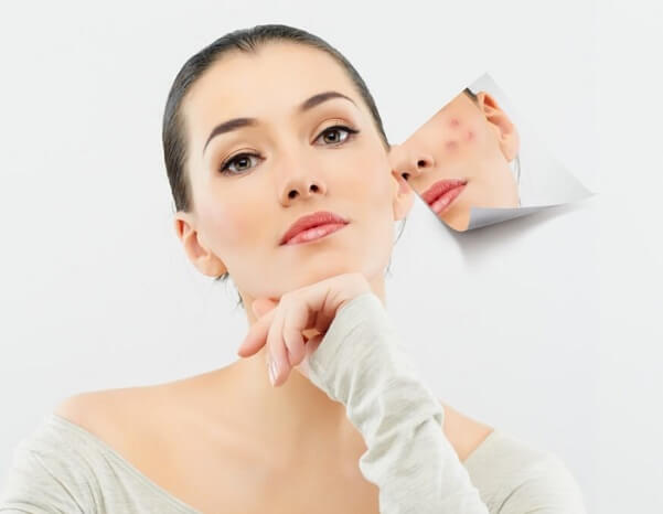 Cà tím giúp làm mờ vết thâm, nám, tàn nhan