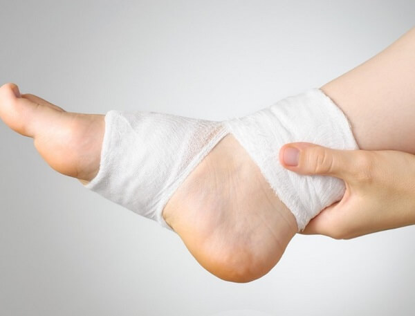 Chăm sóc vết loét bàn chân bệnh nhân tiểu đường
