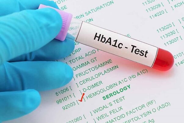 HbA1c giúp bác sĩ chẩn đoán khả năng mắc bệnh tiểu đường của bạn