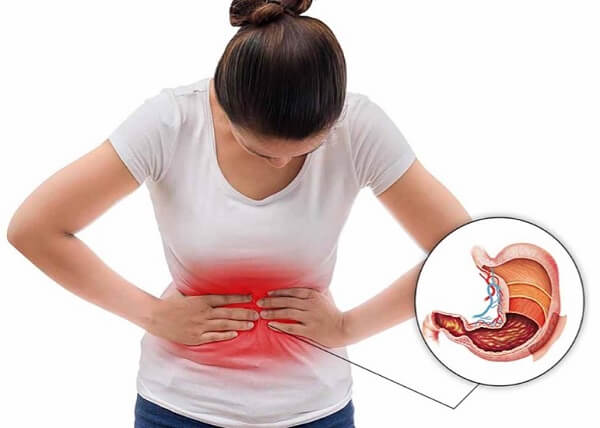 Có thể gây đau bụng hoặc đau dạ dày