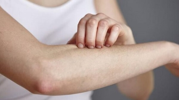 Một số trường hợp có thể bị dị ứng sau khi ăn măng tây