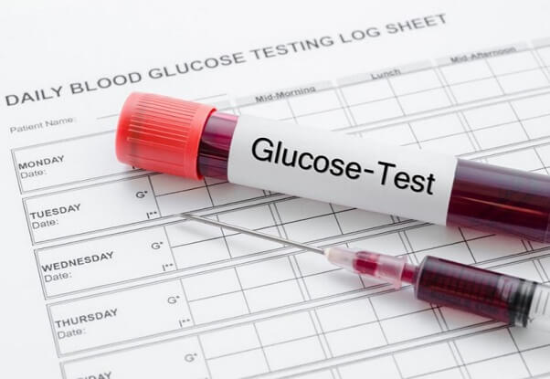 Xét nghiệm glucose trong máu