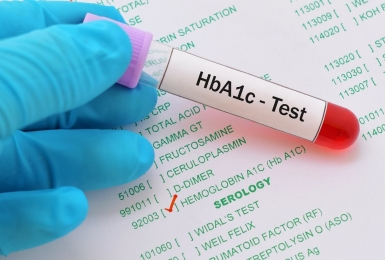  Ý nghĩa của chỉ số HbA1c và cách kiểm soát HbA1c hiệu quả
