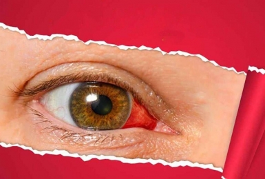 Biến chứng mắt bệnh tiểu đường nguy hiểm dẫn đến mù lòa